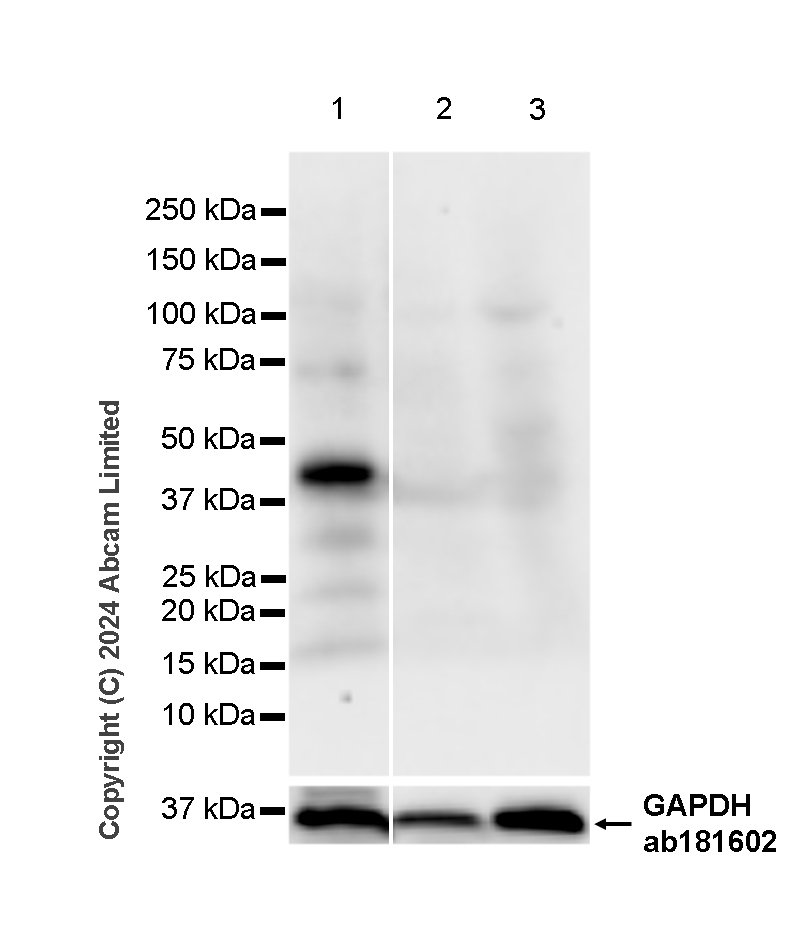 Western blot - Anti-PDX1 antibody [RM1269] (ab323218), expandable thumbnail