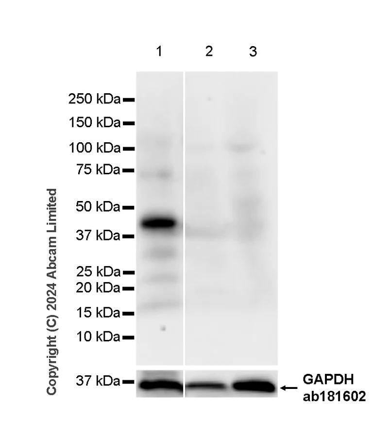 Western blot - Anti-PDX1 antibody [RM1269] (AB323218)