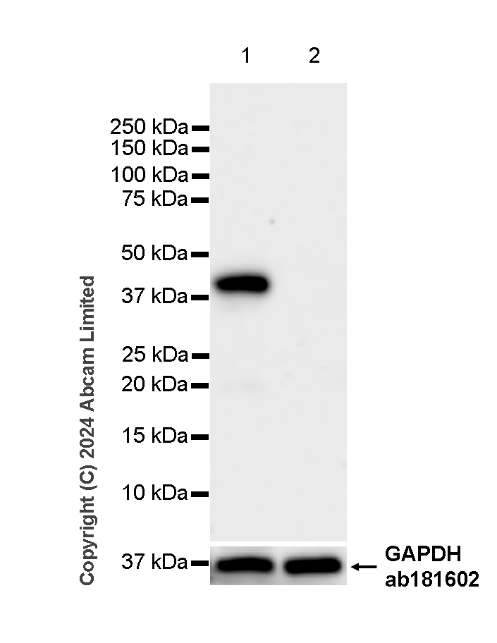 Western blot - Anti-PDX1 antibody [RM1269] (ab323218), expandable thumbnail