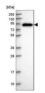 Western blot - Anti-PDXDC1 antibody (AB187971)