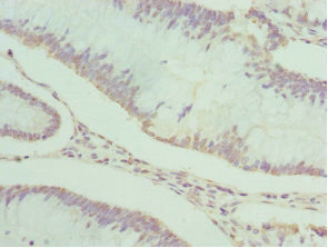 Immunohistochemistry (Formalin/PFA-fixed paraffin-embedded sections) - Anti-PDXK antibody (AB229620)