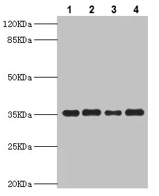 Western blot - Anti-PDXK antibody (AB229620)