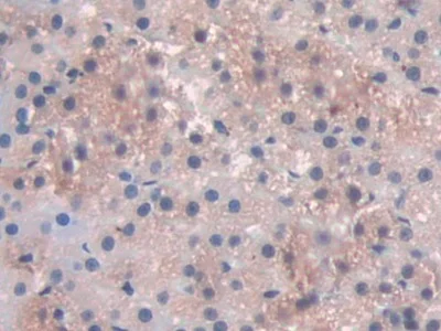 Immunohistochemistry (Formalin/PFA-fixed paraffin-embedded sections) - Anti-PDXK antibody (AB232779)