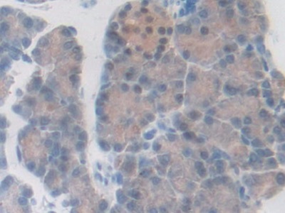 Immunohistochemistry (Formalin/PFA-fixed paraffin-embedded sections) - Anti-PDXK.1 antibody (AB232779)
