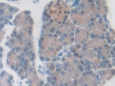 Immunohistochemistry (Formalin/PFA-fixed paraffin-embedded sections) - Anti-PDXK antibody (AB232779)