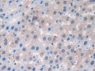 Immunohistochemistry (Formalin/PFA-fixed paraffin-embedded sections) - Anti-PDXK antibody (AB232779)