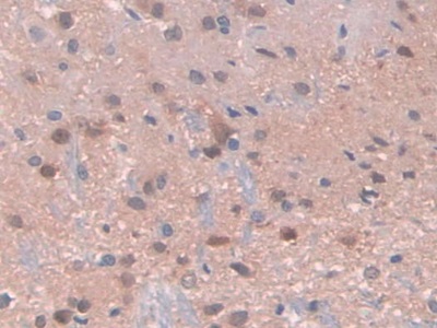 Immunohistochemistry (Formalin/PFA-fixed paraffin-embedded sections) - Anti-PDXK antibody (AB232779)