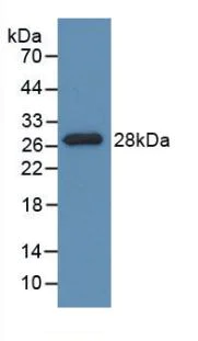 Western blot - Anti-PDXK antibody (AB232779)