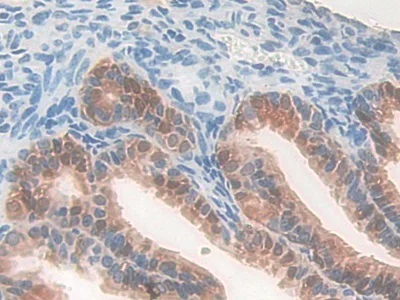 Immunohistochemistry (Formalin/PFA-fixed paraffin-embedded sections) - Anti-PDXK antibody (AB232812)