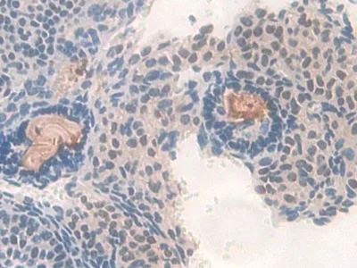 Immunohistochemistry (Formalin/PFA-fixed paraffin-embedded sections) - Anti-PDXK antibody (AB232812)