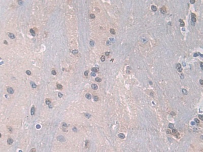 Immunohistochemistry (Formalin/PFA-fixed paraffin-embedded sections) - Anti-PDXK antibody (AB232812)