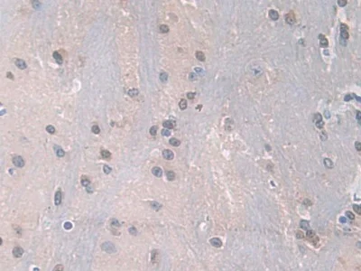 Immunohistochemistry (Formalin/PFA-fixed paraffin-embedded sections) - Anti-PDXK antibody (AB232812)