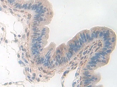 Immunohistochemistry (Formalin/PFA-fixed paraffin-embedded sections) - Anti-PDXK antibody (AB232812)