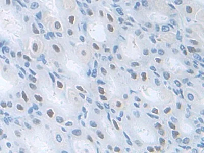 Immunohistochemistry (Formalin/PFA-fixed paraffin-embedded sections) - Anti-PDXK antibody (AB232812)