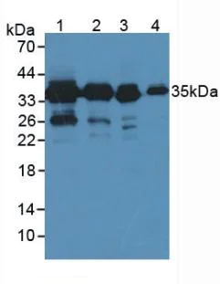 Western blot - Anti-PDXK antibody (AB232812)