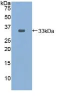 Western blot - Anti-PDXK antibody (AB232812)
