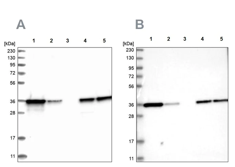 Western blot - Anti-PDXK antibody (AB251802)