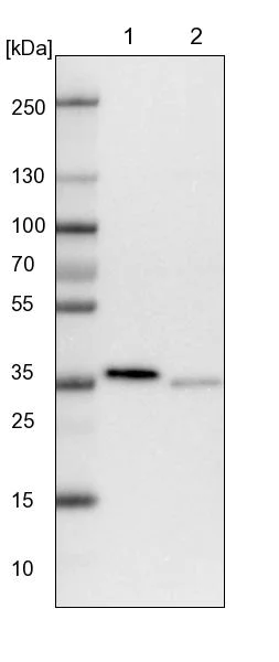 Western blot - Anti-PDXK antibody (AB251802)