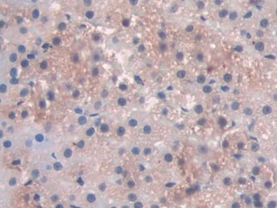 Immunohistochemistry (Formalin/PFA-fixed paraffin-embedded sections) - Anti-PDXK.1 antibody (AB232779), expandable thumbnail