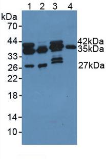 Western blot - Anti-PDXK.1 antibody (AB232779), expandable thumbnail
