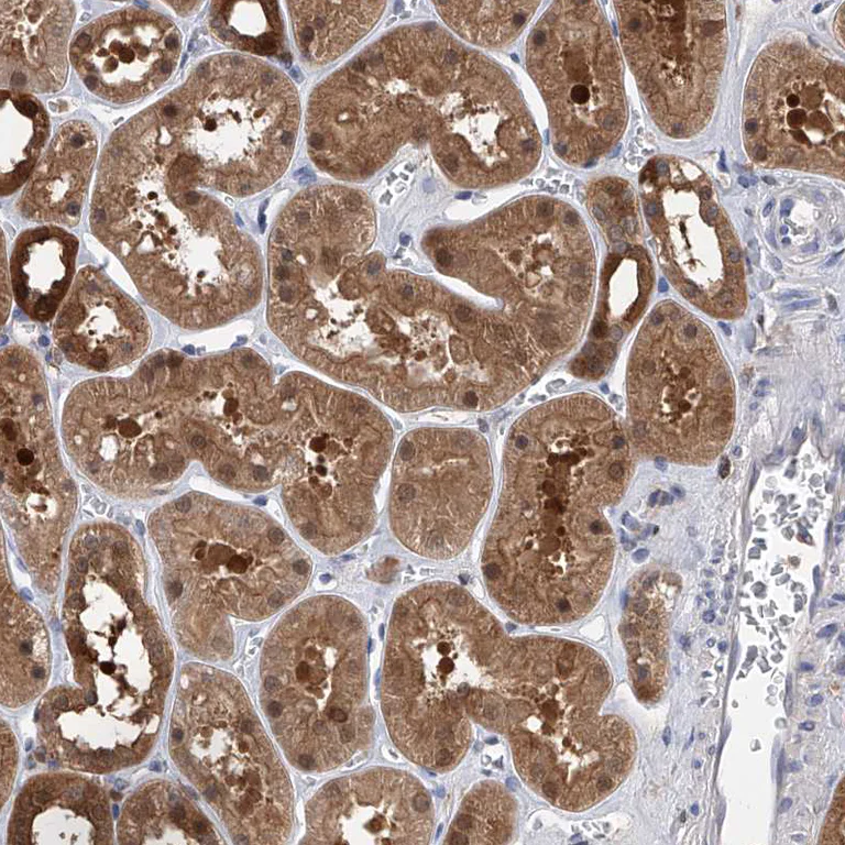Immunohistochemistry (Formalin/PFA-fixed paraffin-embedded sections) - Anti-PDXK.1 antibody (AB251802)