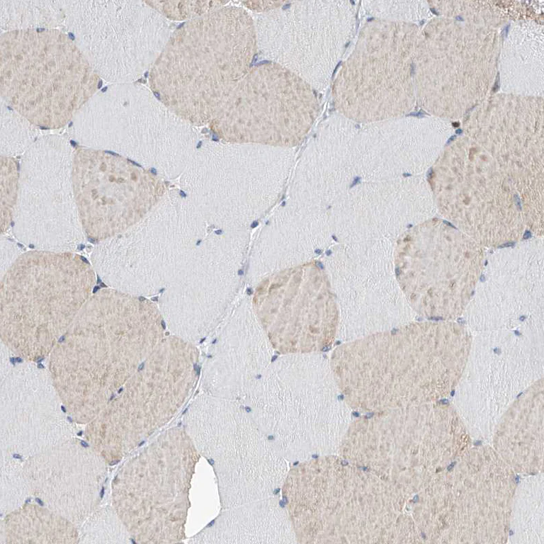 Immunohistochemistry (Formalin/PFA-fixed paraffin-embedded sections) - Anti-PDXK.1 antibody (AB251802)