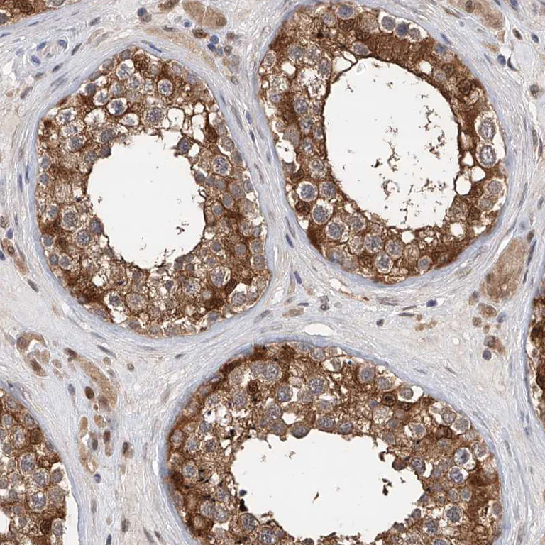 Immunohistochemistry (Formalin/PFA-fixed paraffin-embedded sections) - Anti-PDXK.1 antibody (AB251802)