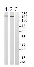 Western blot - Anti-PDZ-RhoGEF antibody (AB110059)