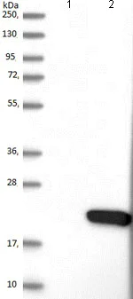 Western blot - Anti-PDZD11 antibody (AB121210)