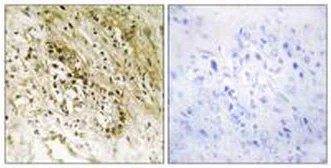 Immunohistochemistry (Formalin/PFA-fixed paraffin-embedded sections) - Anti-PDZK3/Pin1 antibody (AB196631)