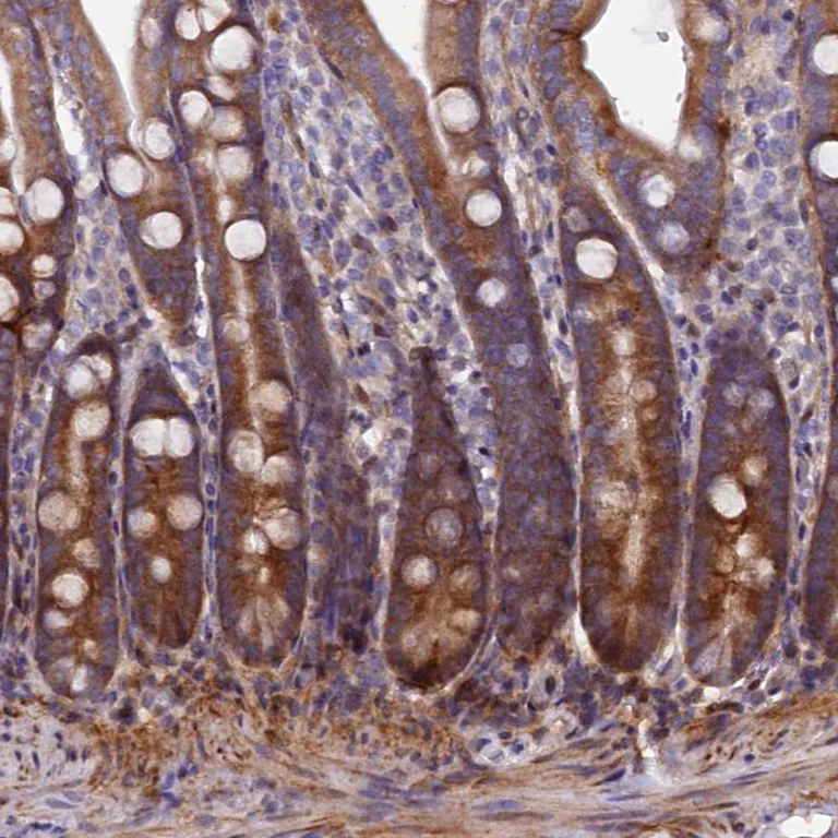Immunohistochemistry (Formalin/PFA-fixed paraffin-embedded sections) - Anti-PDZRN3 antibody (AB272628)