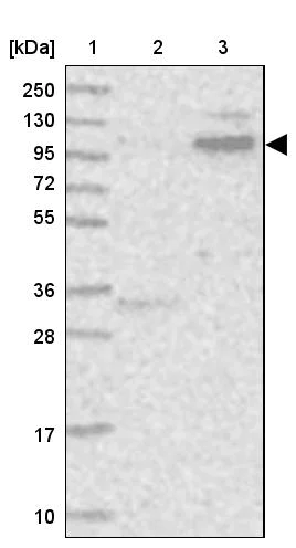 Western blot - Anti-PDZRN3 antibody (AB272628)