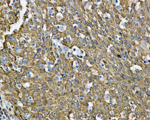 Immunohistochemistry (Formalin/PFA-fixed paraffin-embedded sections) - Anti-PDZRN4 antibody [EPR11852] (AB171083)