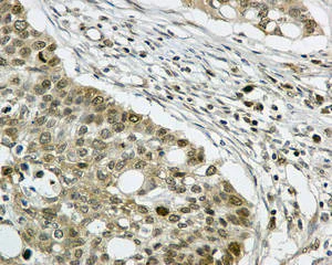 Immunohistochemistry (Formalin/PFA-fixed paraffin-embedded sections) - Anti-PDZRN4 antibody [EPR11852] (AB171083)