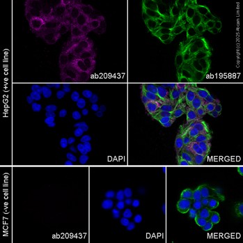 Immunocytochemistry/ Immunofluorescence - PE Anti-ALDH1A1 antibody [EP1933Y] (AB209437)