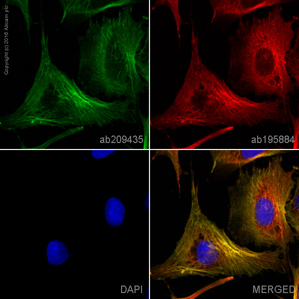 Immunocytochemistry/ Immunofluorescence - PE Anti-alpha smooth muscle Actin (acetyl E3) + ACTG2 (acetyl E3) antibody [E184] (AB209435), expandable thumbnail