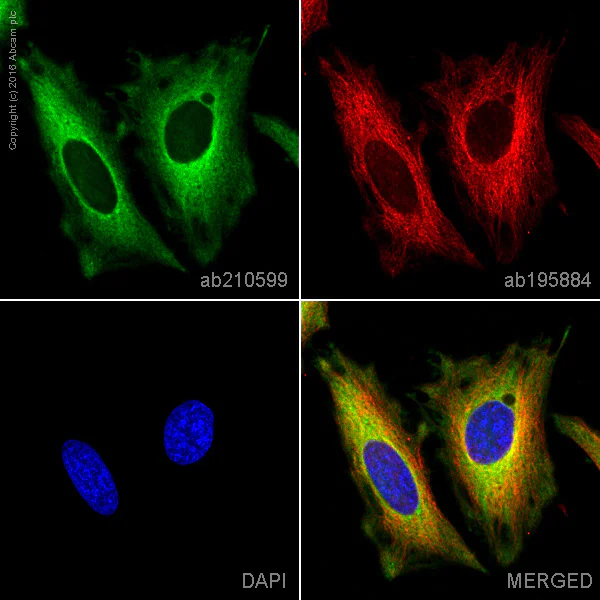 Immunocytochemistry/ Immunofluorescence - PE Anti-AMF antibody [EPR11663(B)] (AB210599)