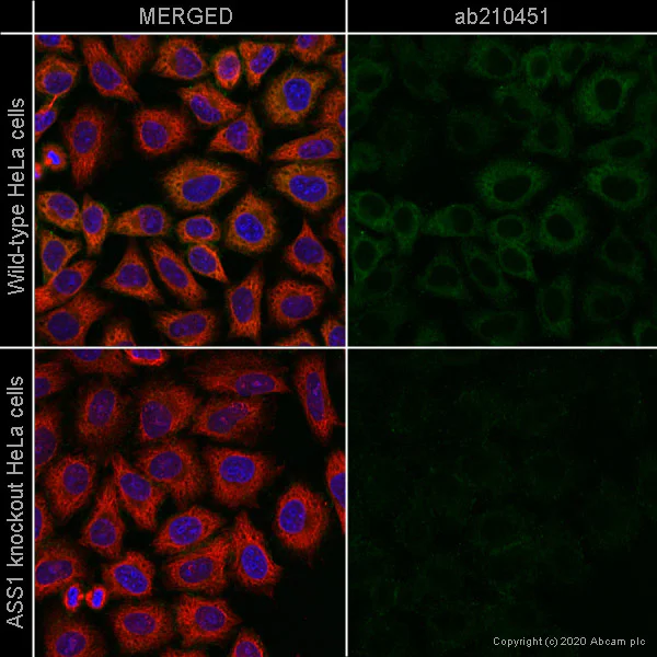 Immunocytochemistry/ Immunofluorescence - PE Anti-ASS1 antibody [EPR12398] (AB210451)