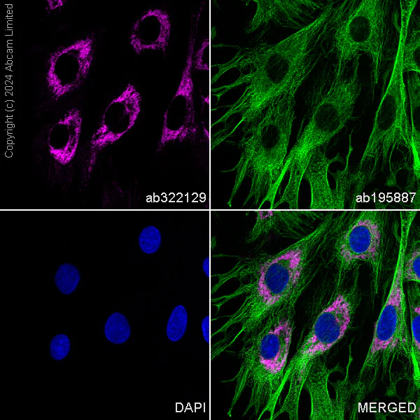 Immunocytochemistry/ Immunofluorescence - PE Anti-Cardiac Troponin T antibody [EPR20266] (AB322129)