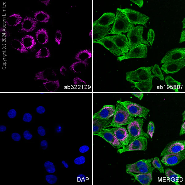 Immunocytochemistry/ Immunofluorescence - PE Anti-Cardiac Troponin T antibody [EPR20266] (AB322129)