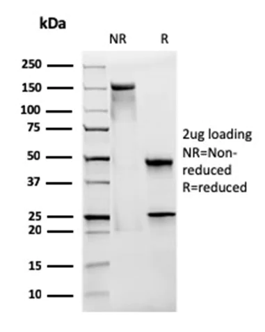 SDS-PAGE - PE Anti-CD28 antibody [CB28] (AB193332)