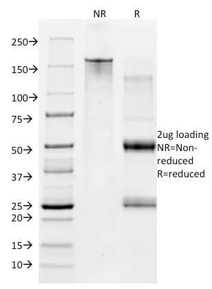 SDS-PAGE - PE Anti-CD28 antibody [CB28] (AB193332)