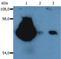 Western blot - PE Anti-CD44 antibody [MEM-263] (AB58754), expandable thumbnail