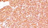 Immunohistochemistry (Formalin/PFA-fixed paraffin-embedded sections) - PE Anti-CD45RB antibody [BRA-11] (AB194400)
