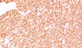 Immunohistochemistry (Formalin/PFA-fixed paraffin-embedded sections) - PE Anti-CD45RB antibody [BRA-11] (AB194400)