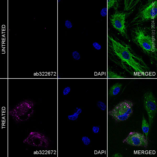 Immunocytochemistry/ Immunofluorescence - PE Anti-CD62E antibody [EPR25616-62] (AB322672)