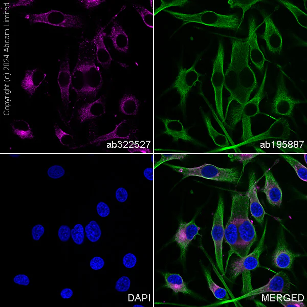 Immunocytochemistry/ Immunofluorescence - PE Anti-CD63 antibody [EPR22458-280] (AB322527)