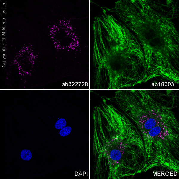 Immunocytochemistry/ Immunofluorescence - PE Anti-CD63 antibody [KILL150A] (AB322728), expandable thumbnail