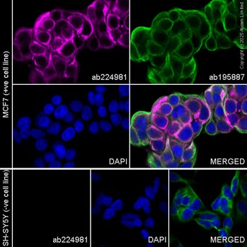 Anti-Cytokeratin 19 PE antibody [EP1580Y] (ab224981) IgG | Abcam