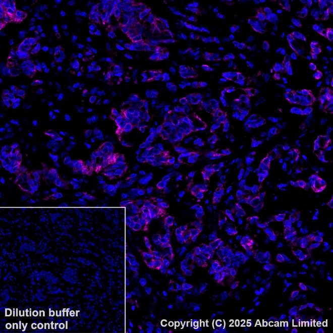 Anti-Cytokeratin 19 PE antibody [EP1580Y] (ab224981) IgG | Abcam